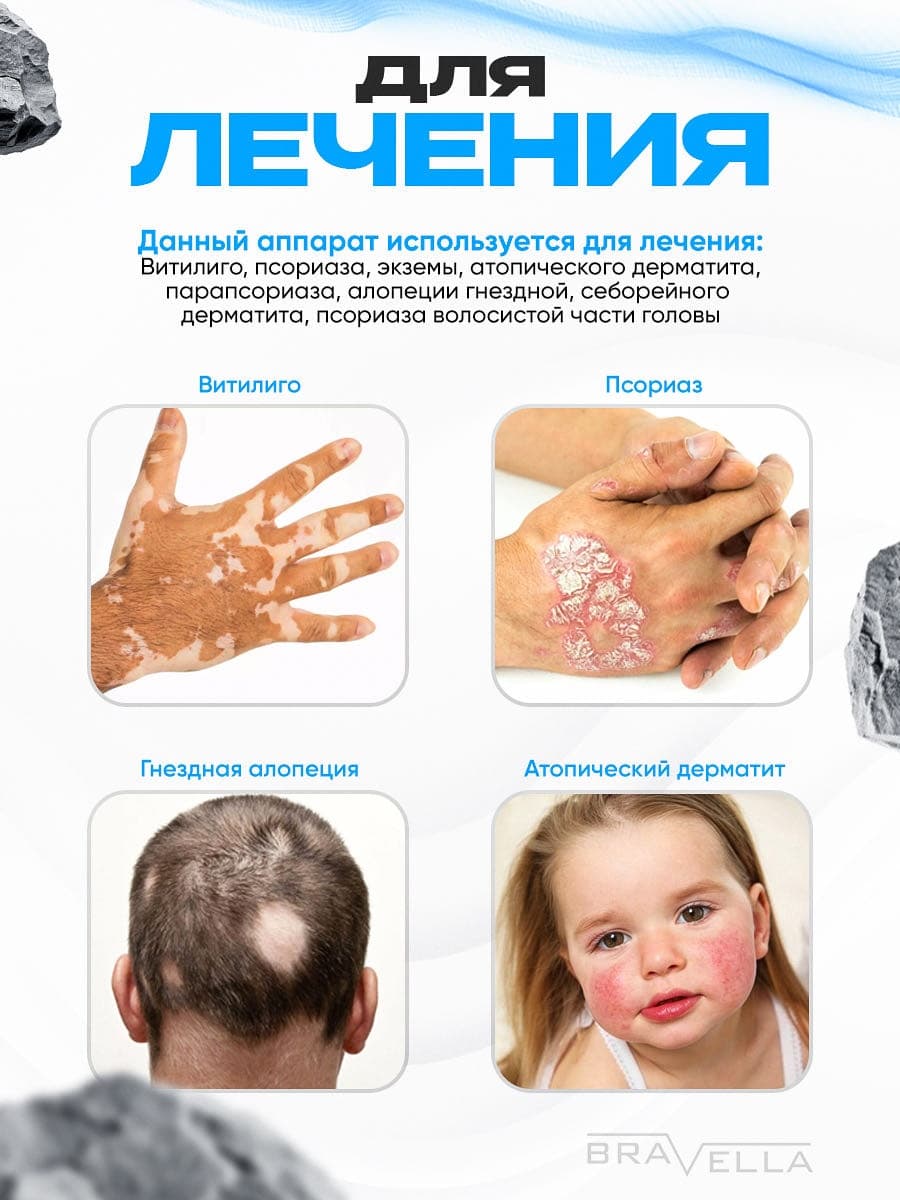 Аппарат фототерапии Bravella Brav4 (расчёска) — фото 2
